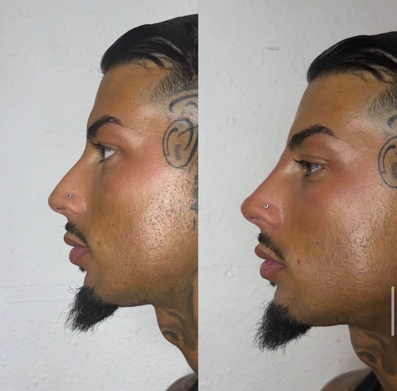 Andrea Catahysa Del Torto-6