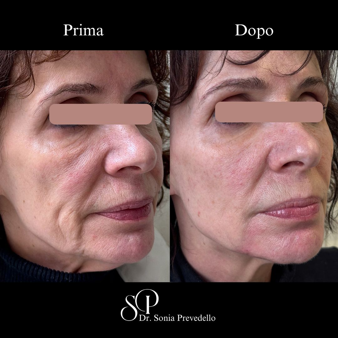 Sonia Prevedello-3