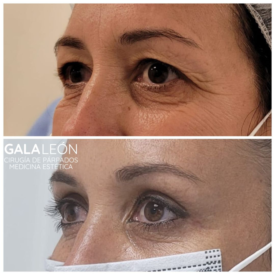 Gala P. Leon Salvatierra-11