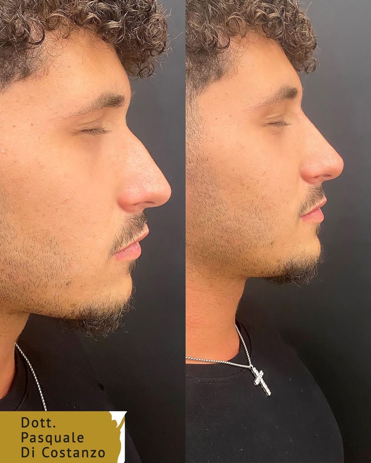 Pasquale Di Costanzo-43