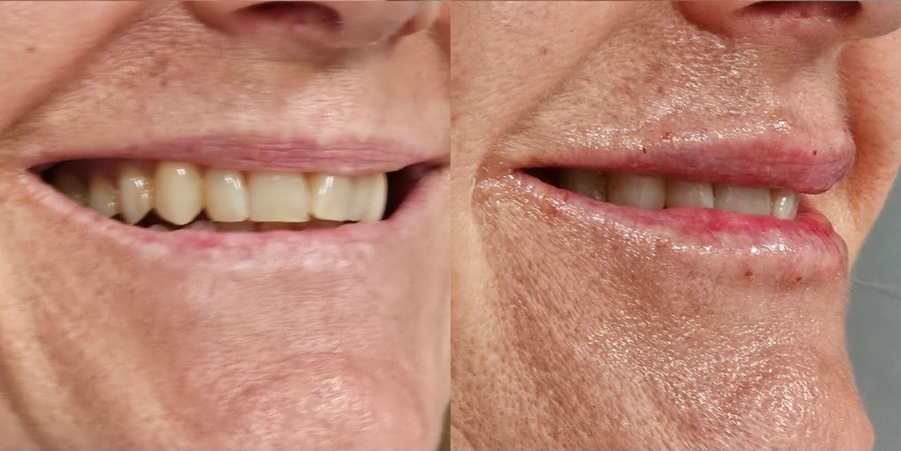 Rosalba Herrero Zerpa-515