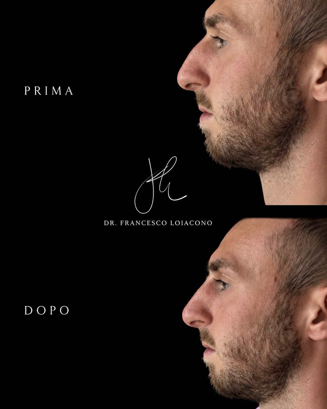 Francesco Loiacono-1