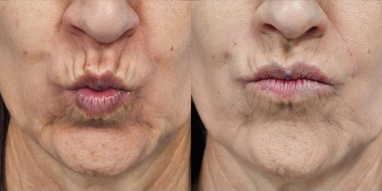 Rosalba Herrero Zerpa-8