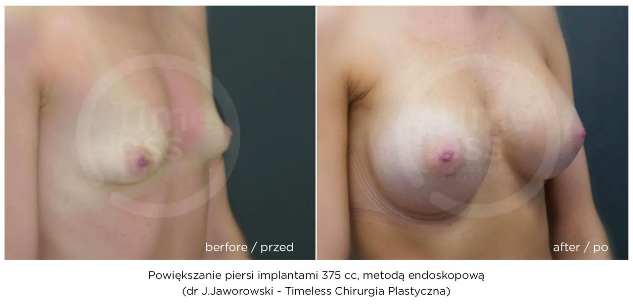 Janusz Jaworowski-117