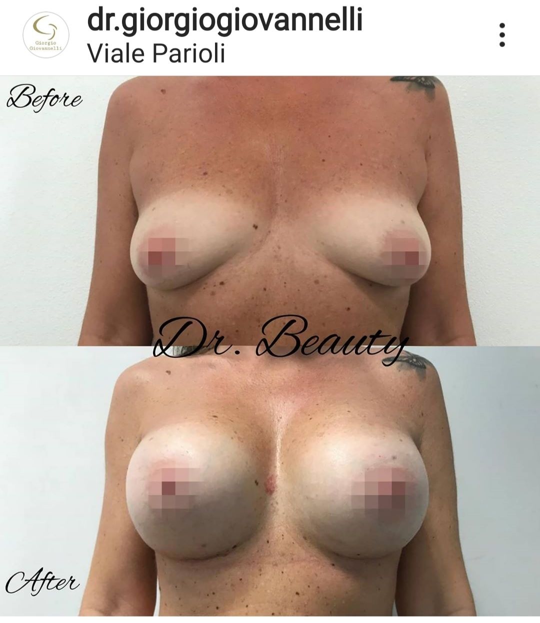 Giorgio Giovannelli-29