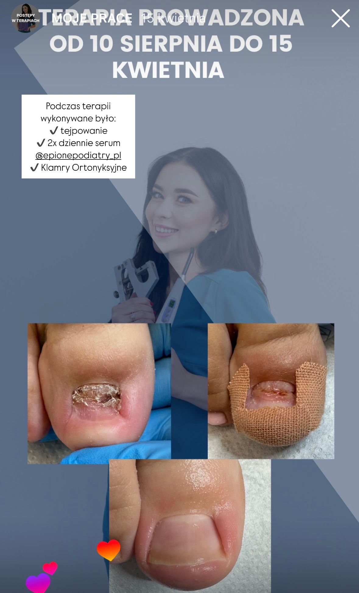 Karolina Colonna-Walewska-2