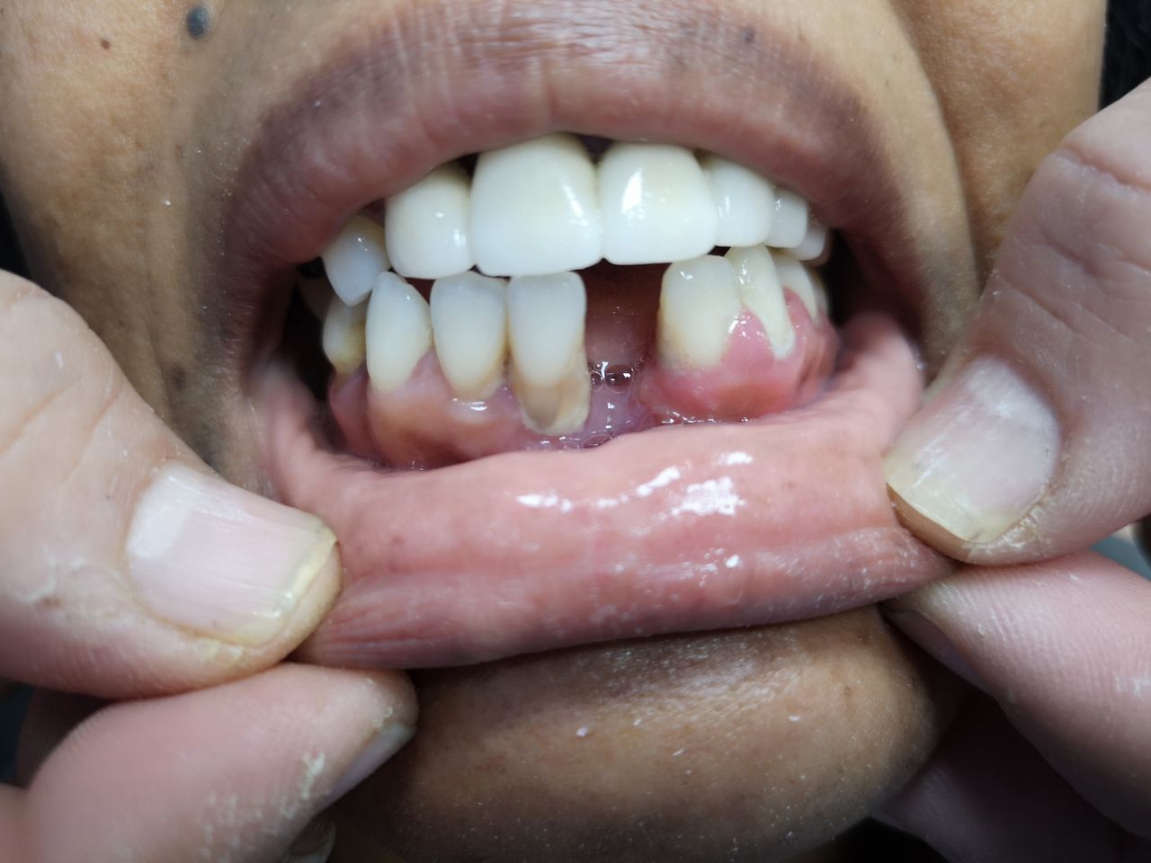 Stefano De Simone-70