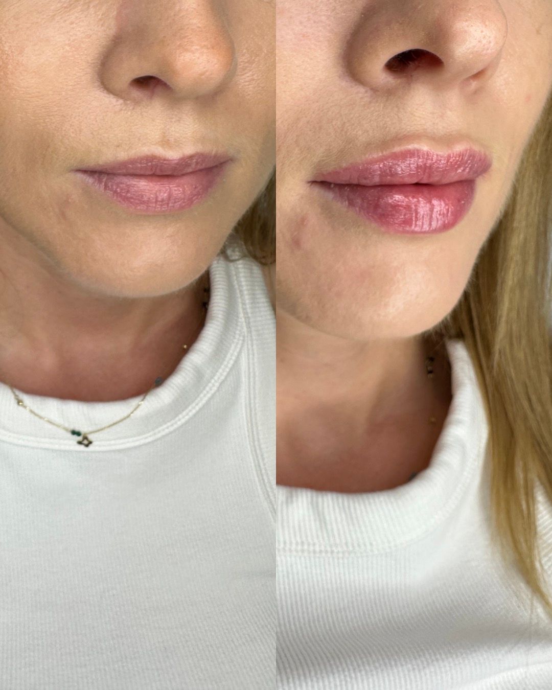 Michalina Zagańczyk-Bączek-24