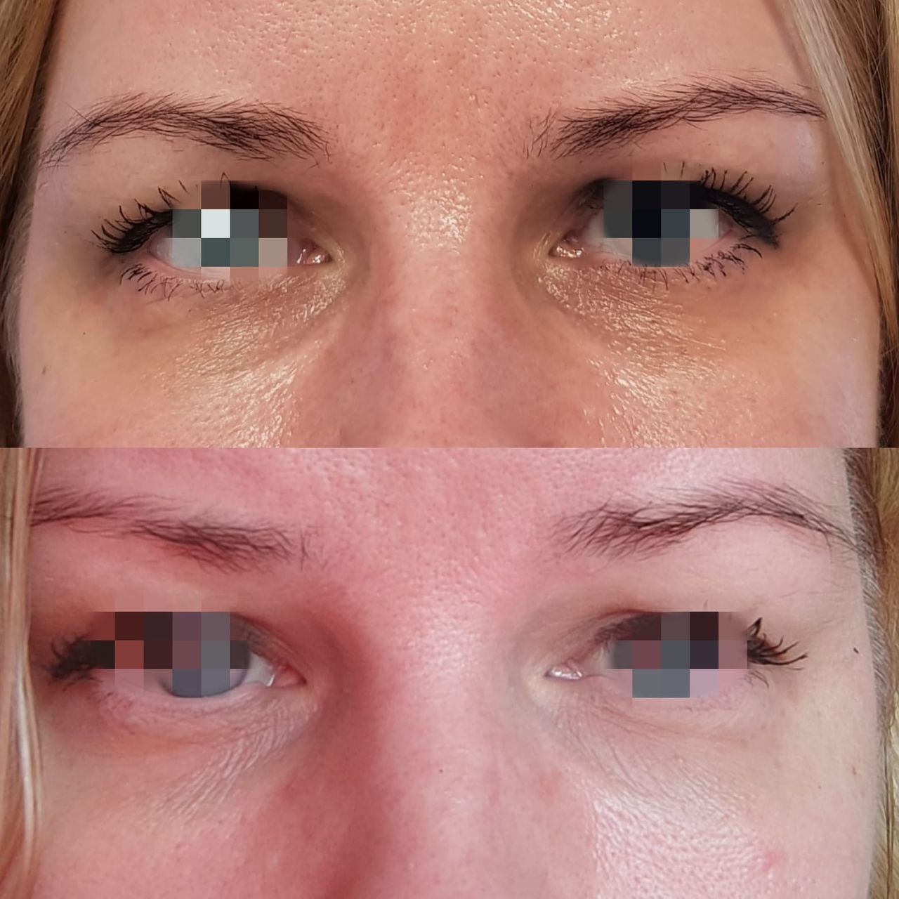 Rosalba Herrero Zerpa-224