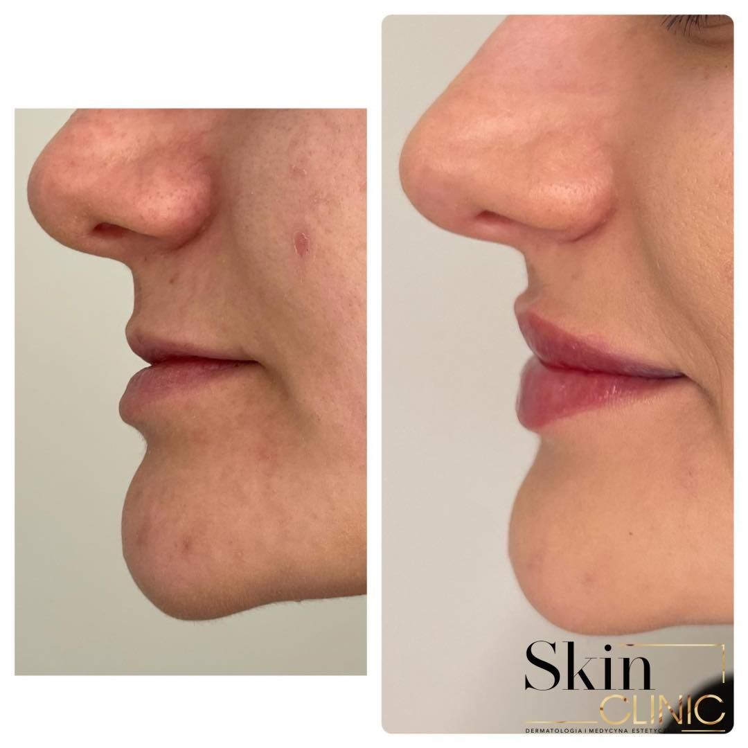 Alina Skrzypek-Salamon-3