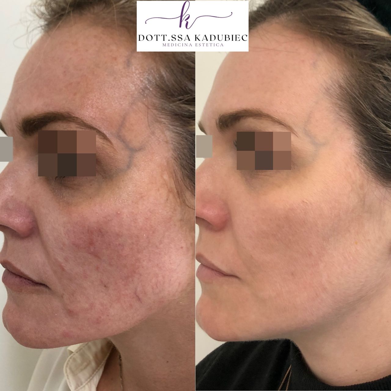 Aleksandra Kadubiec-15