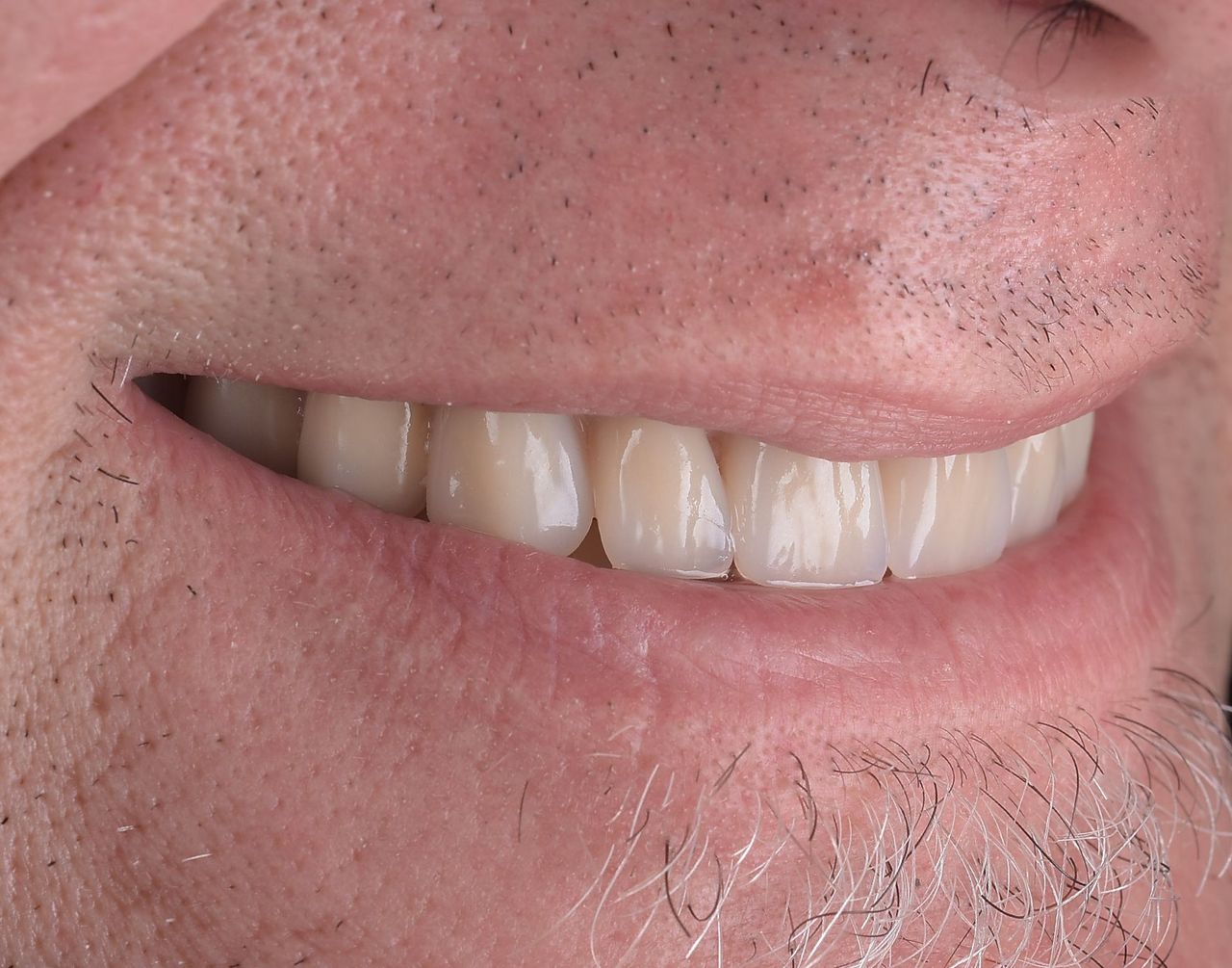 Riccardo Giardina-22