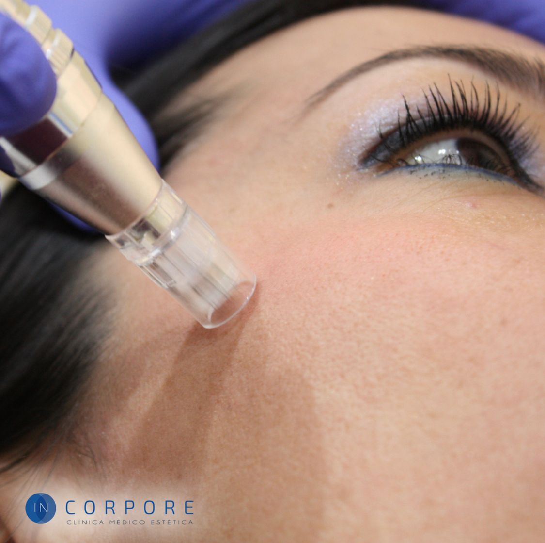 Juan Enrique Pérez Enríquez-96