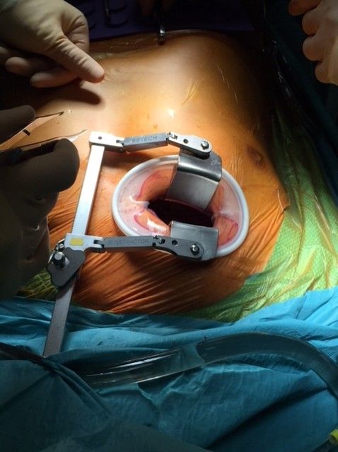 Guillermo Reyes Copa-5