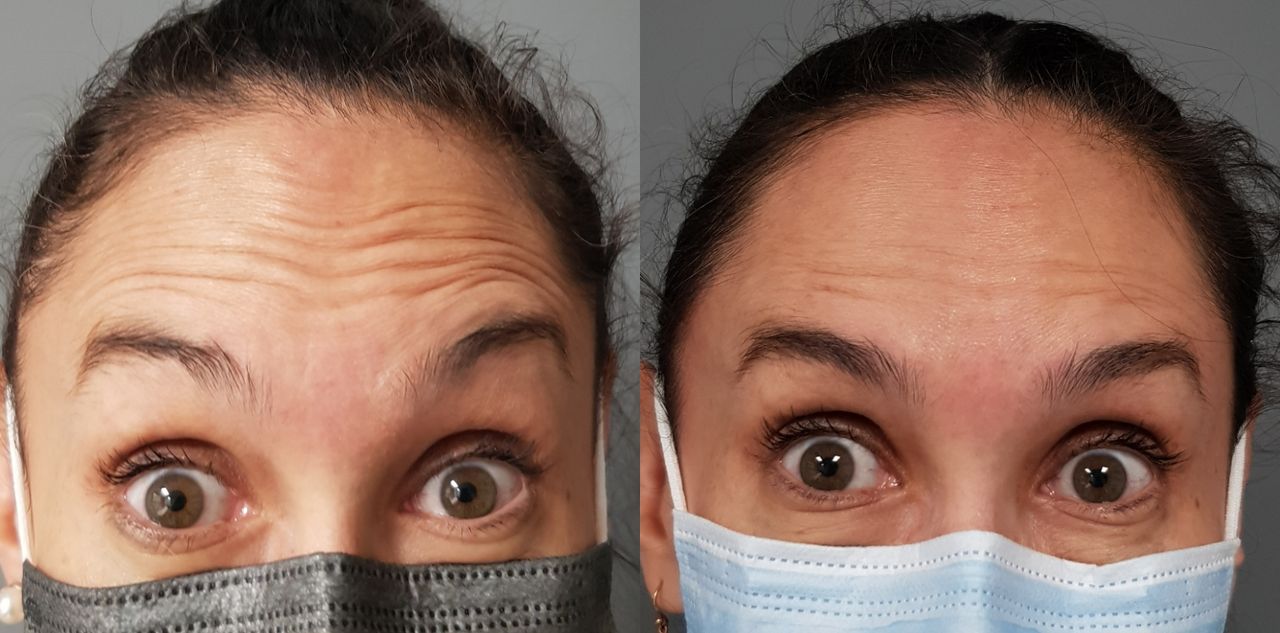 Rosalba Herrero Zerpa-115