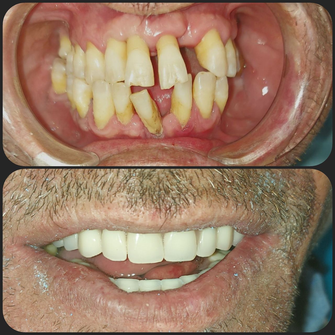 Lorenzo Paolo Bottini-3