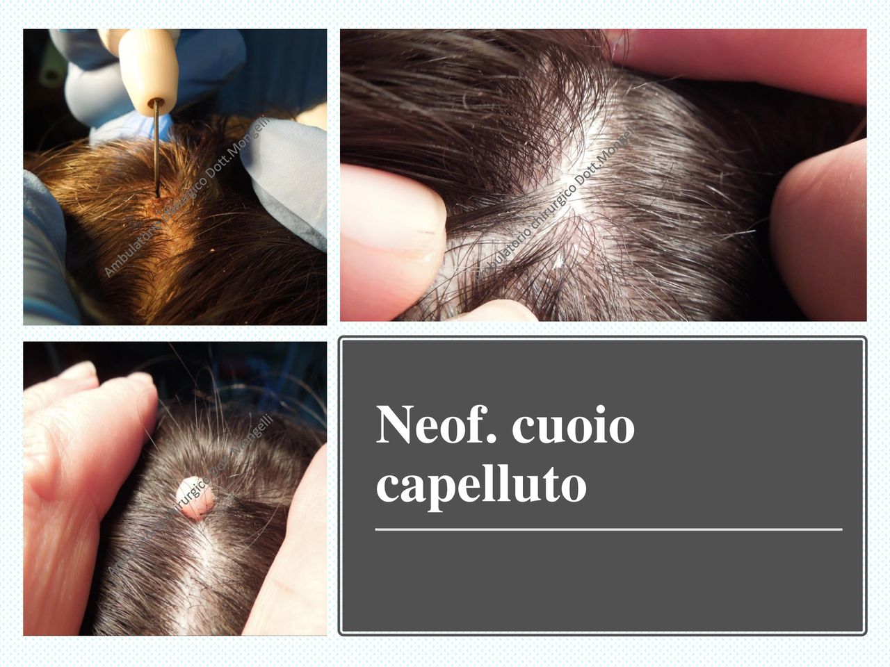 Matteo Antonio Mongelli-20