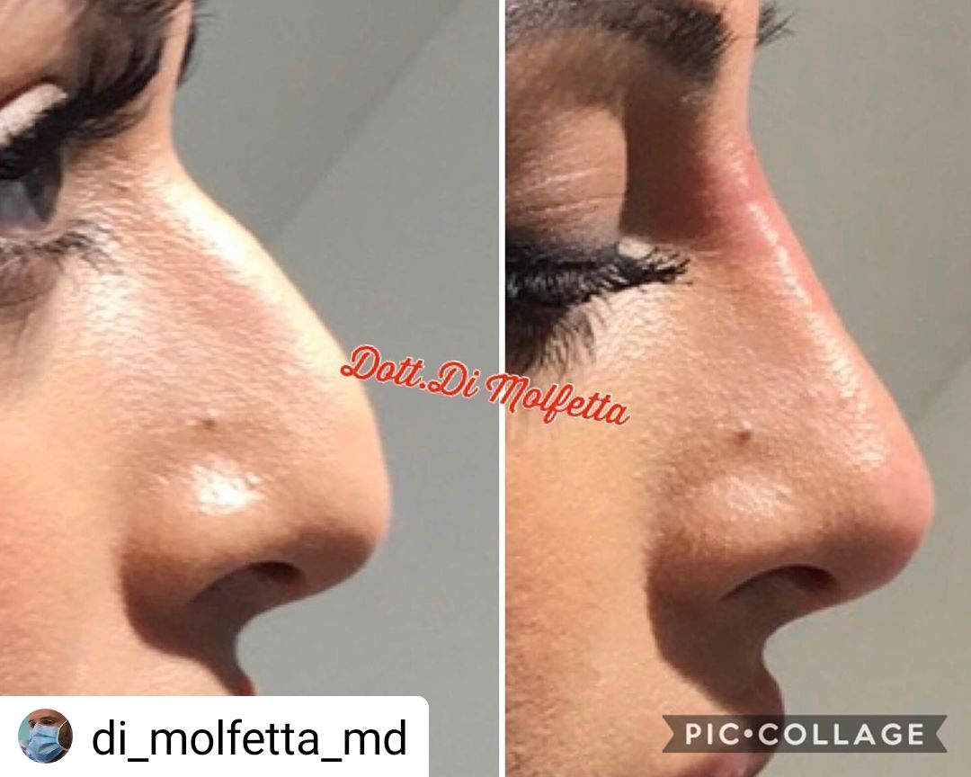 Pasquale Di Molfetta-17