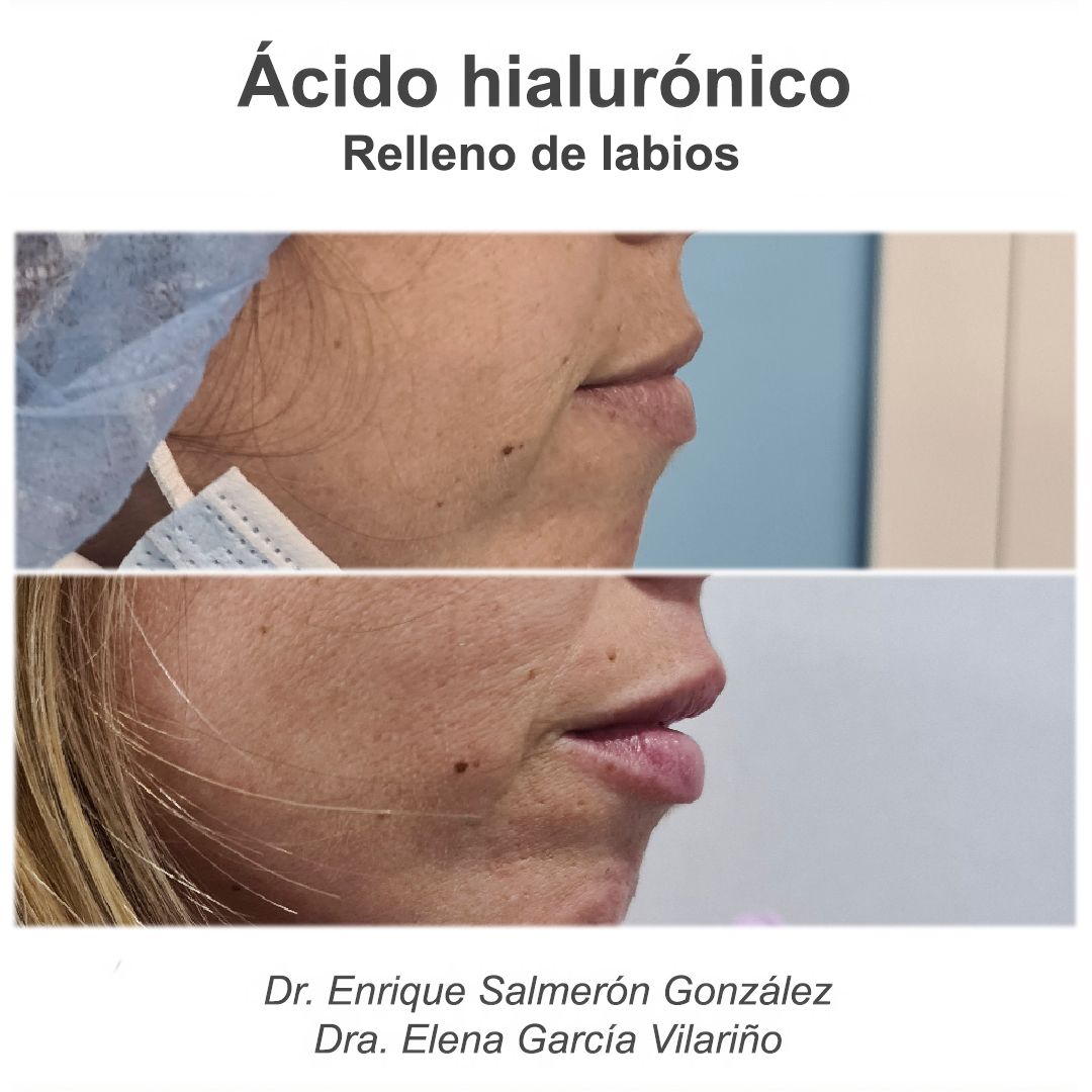 Enrique Salmerón González-79