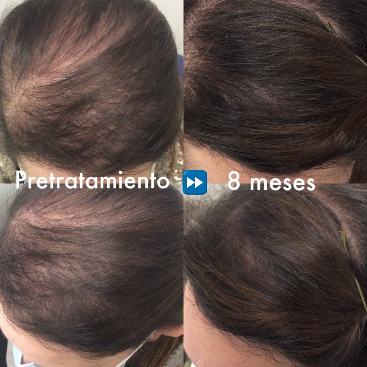 Pablo Martín Carrasco-10