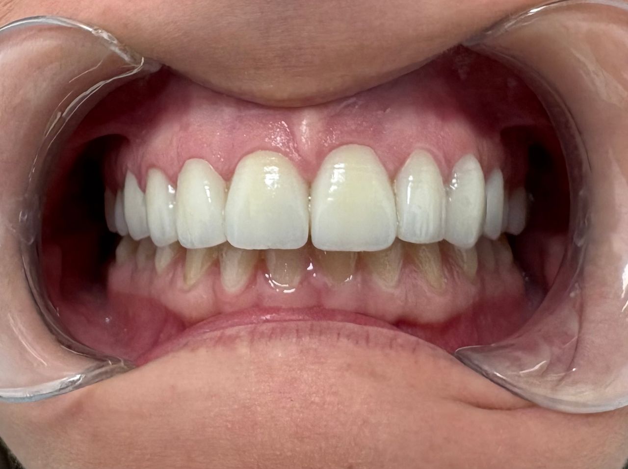 César Buján Riveiro-5