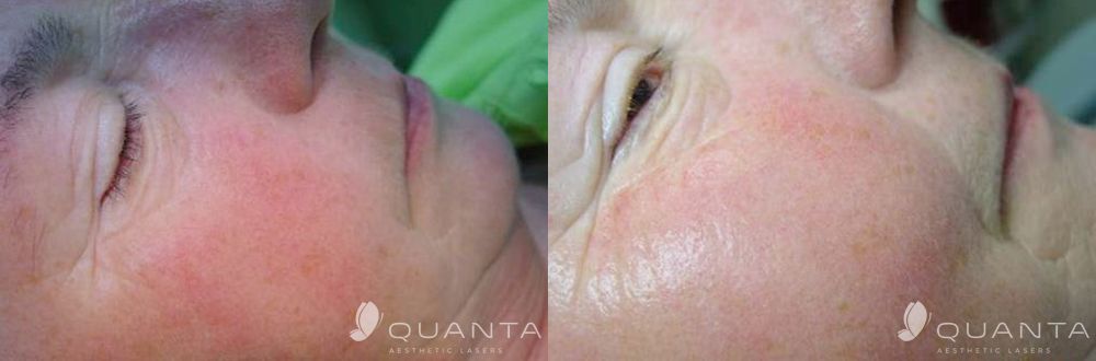 Enzo Angelo Giudice-15