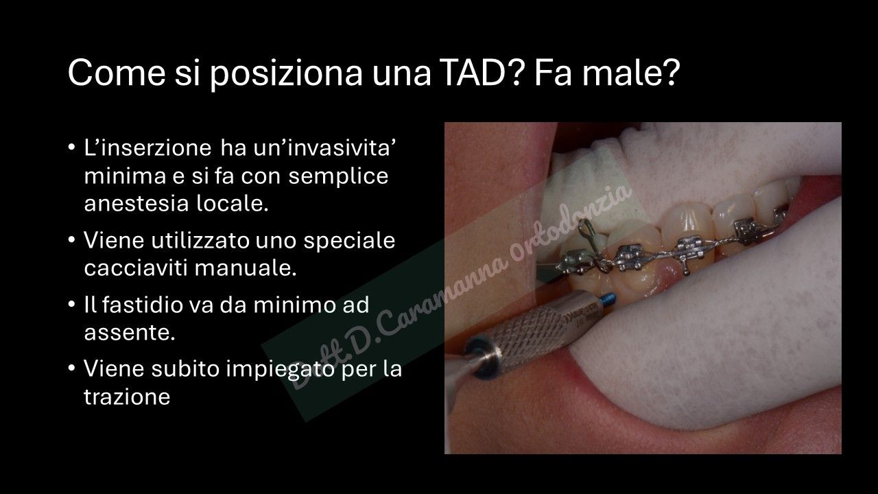 Daniele Caramanna-32