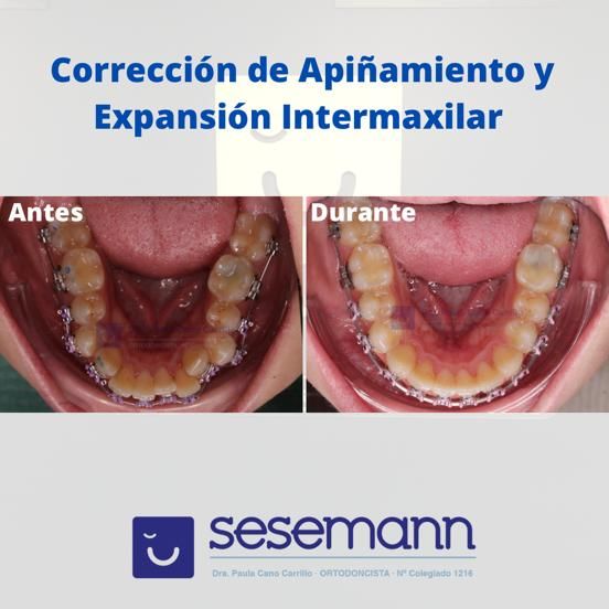 Paula Cano Carrillo-47