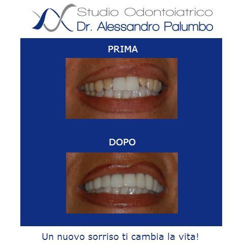 Alessandro Palumbo-20