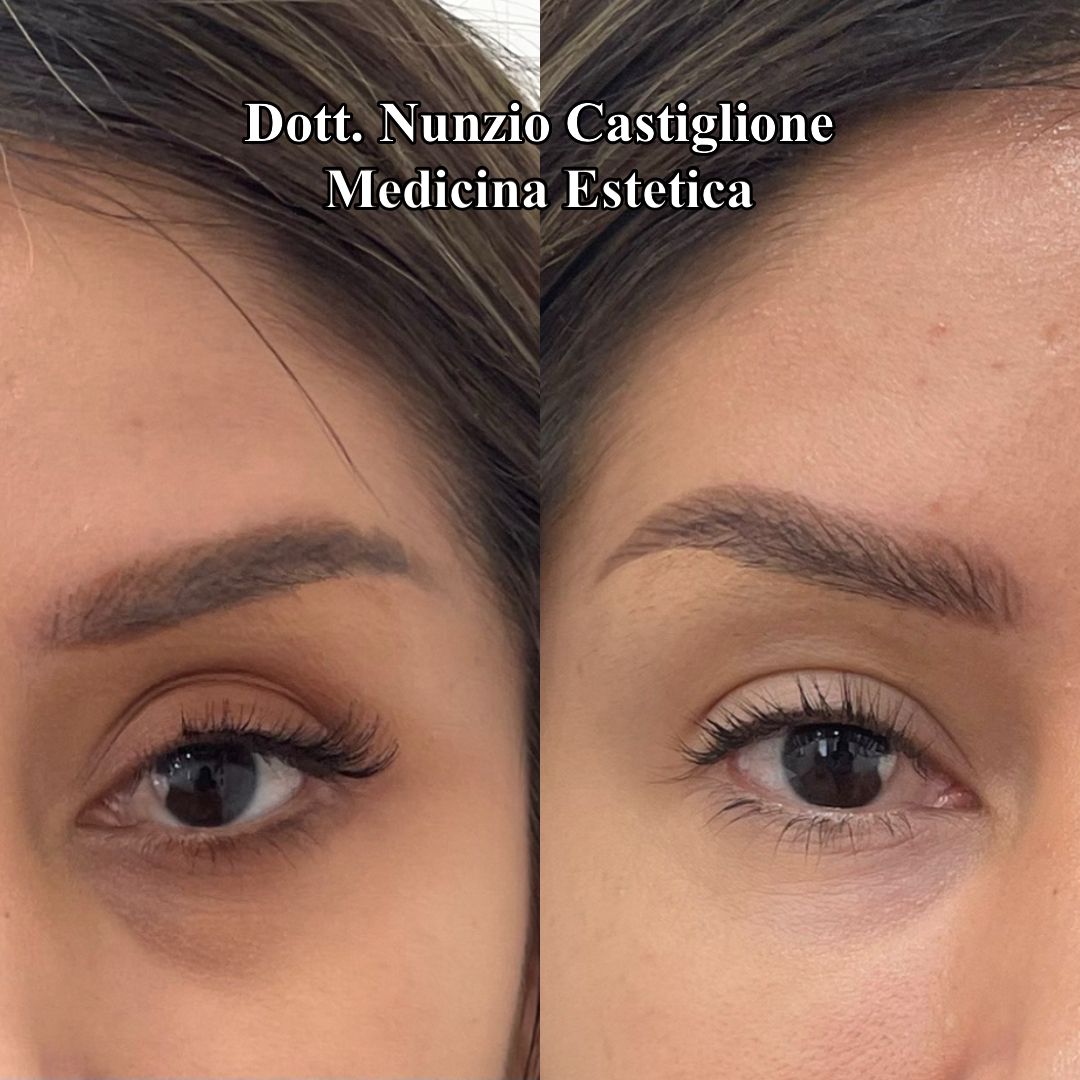 Nunzio Castiglione-7