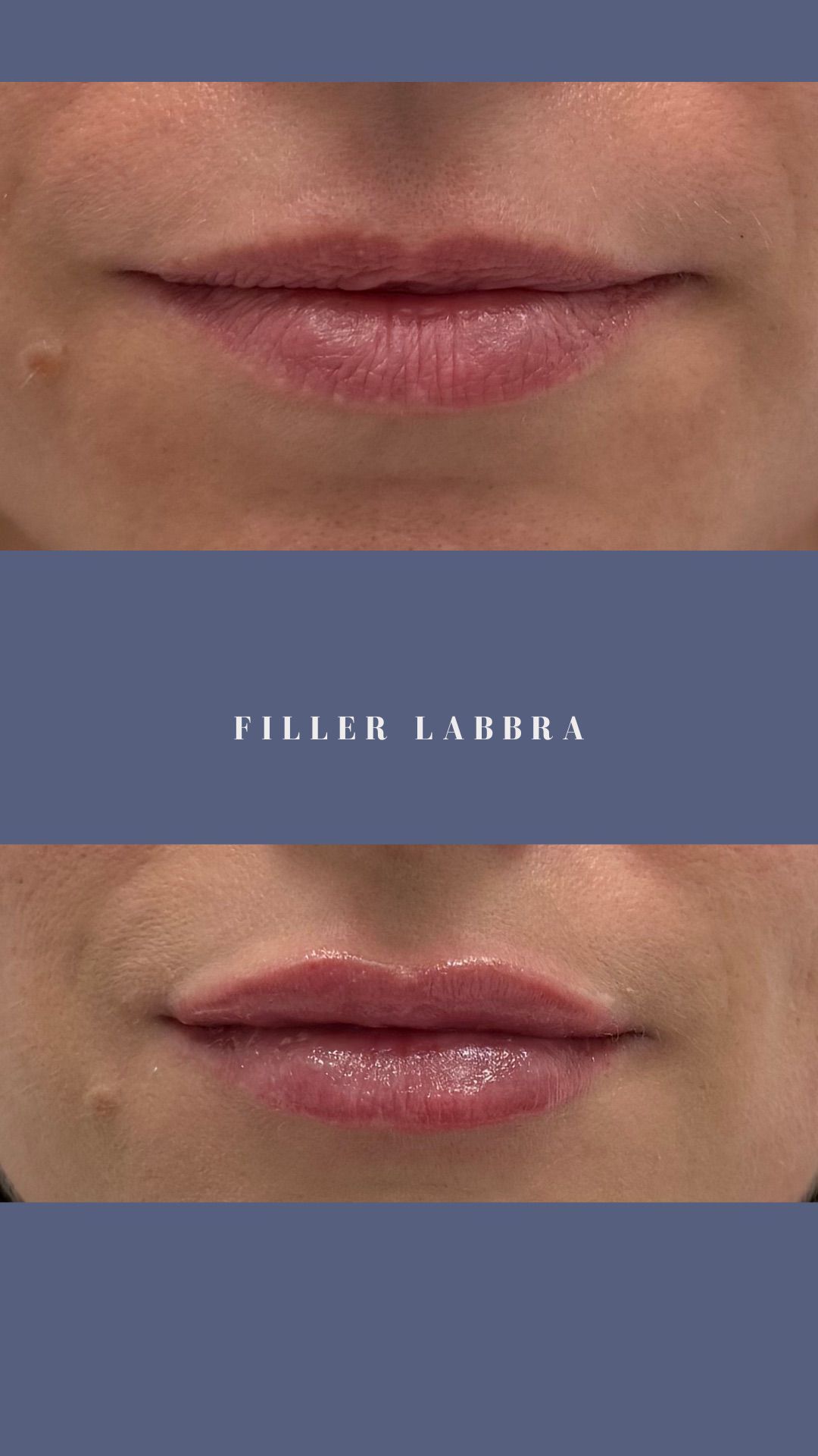 Federica Di Ruscio-10