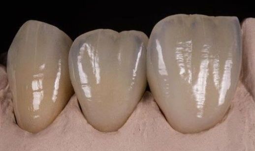 Stefano De Simone-121