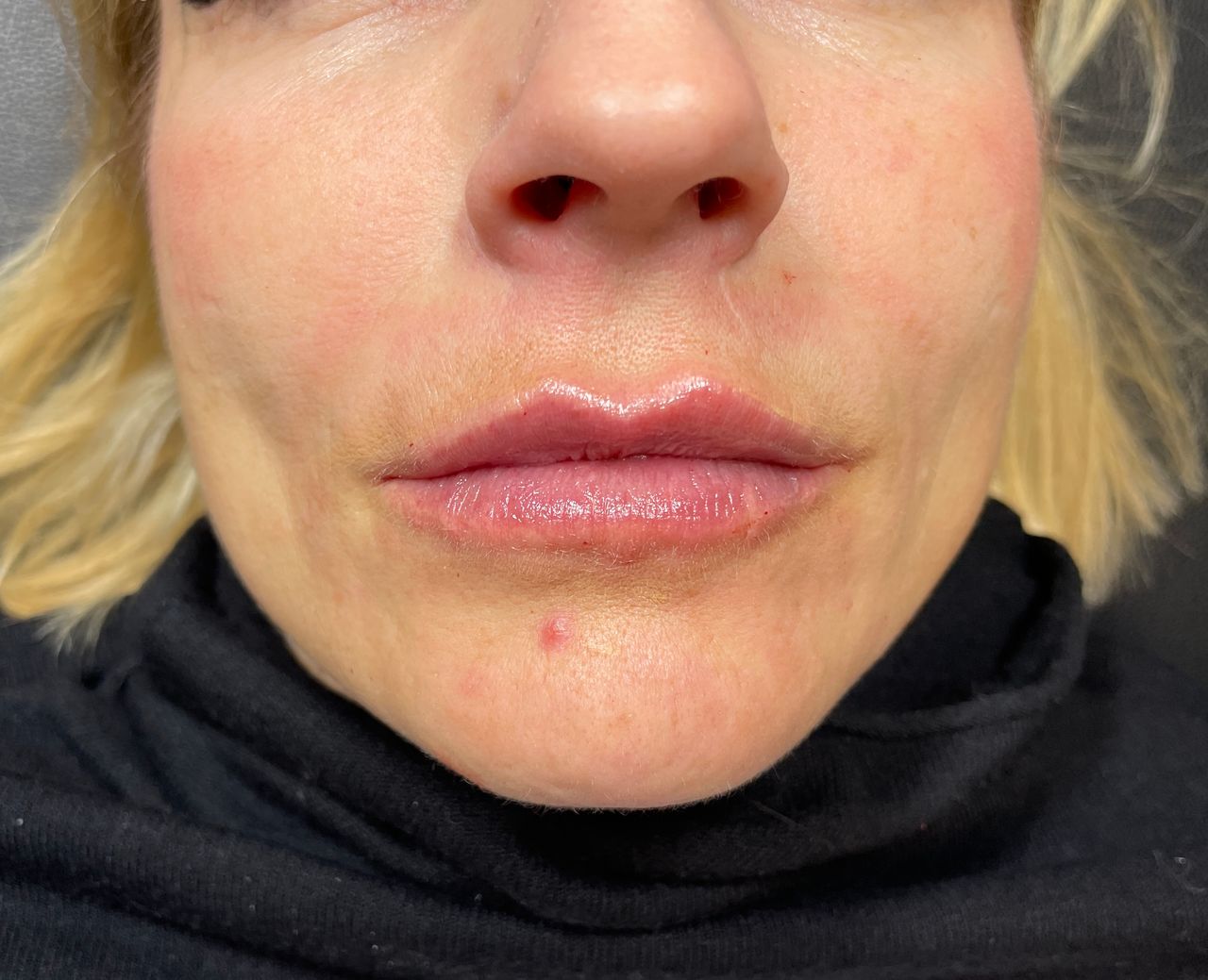 Alberto Alessandri-17