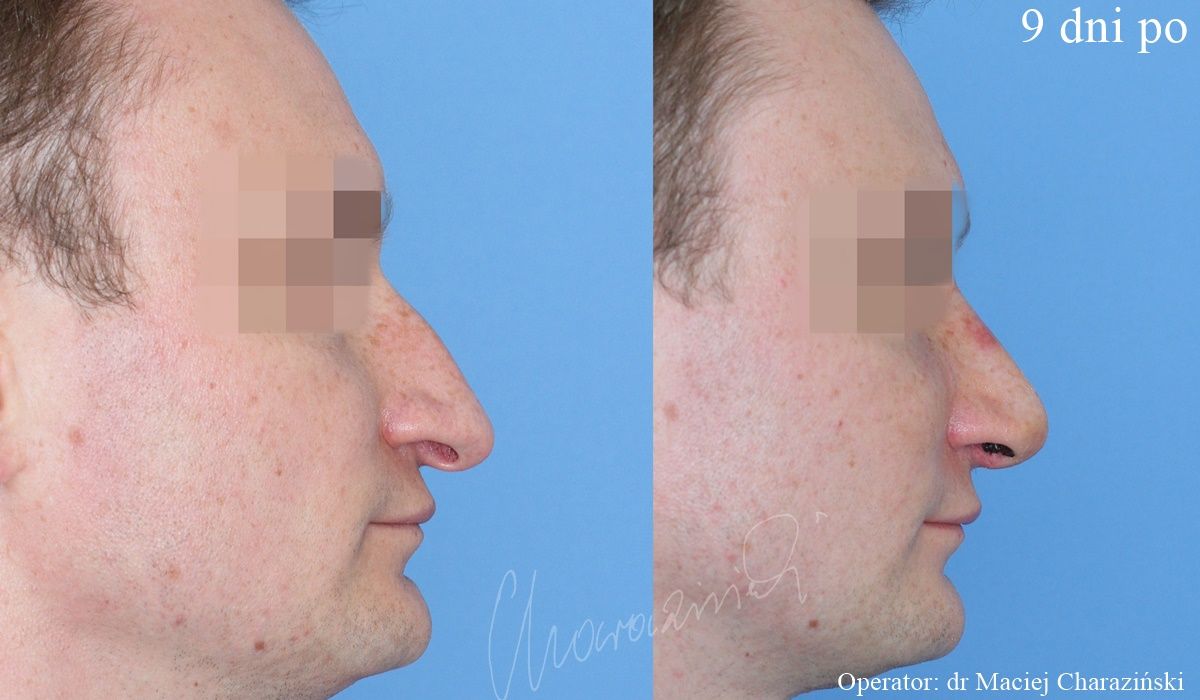 Maciej Charaziński-26