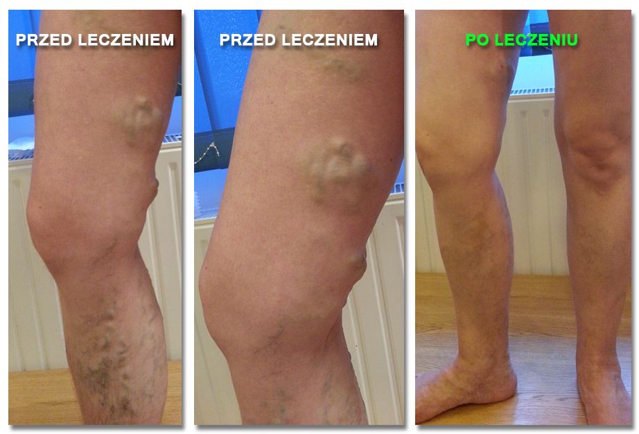 Tomasz Krzysztof Kwiatkowski-1