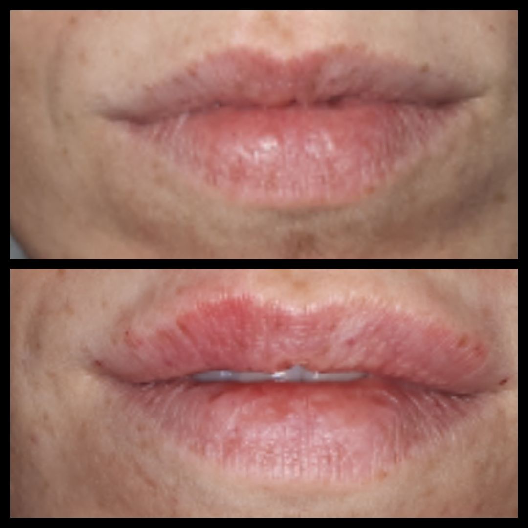 Andrea Menichelli-21