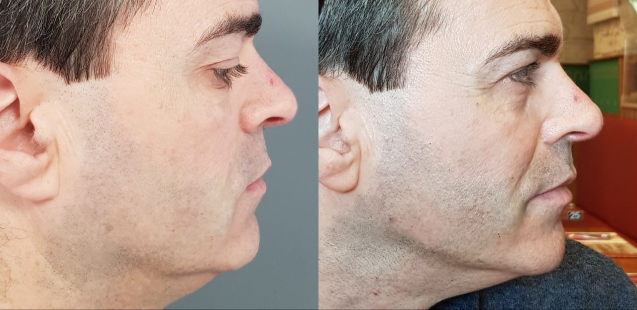 Rosalba Herrero Zerpa-158