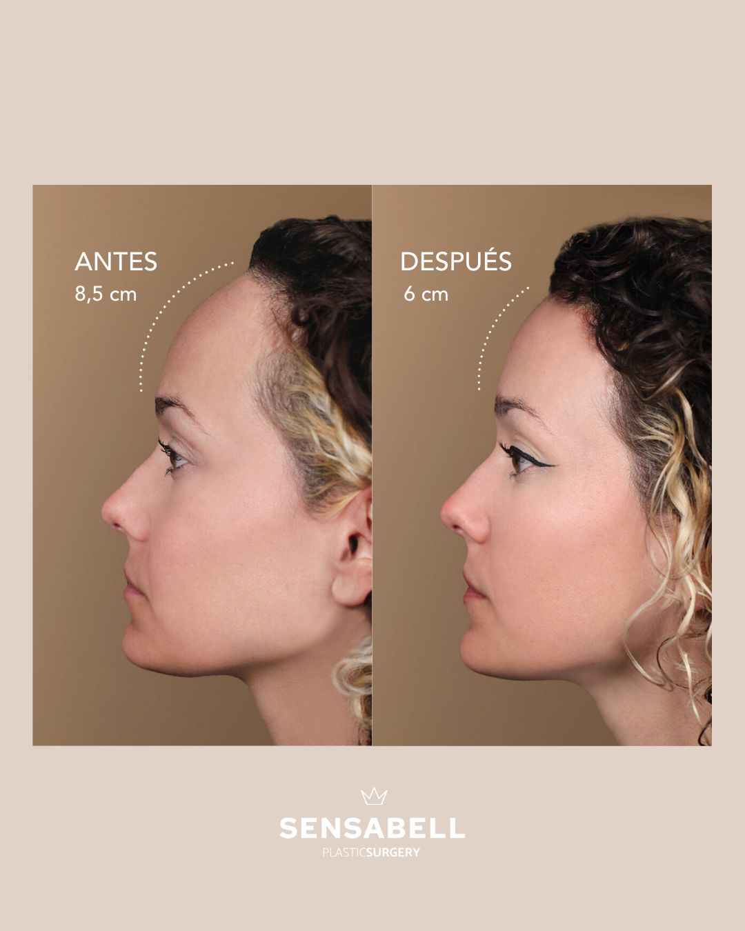 Eloy Condiño Brito-5