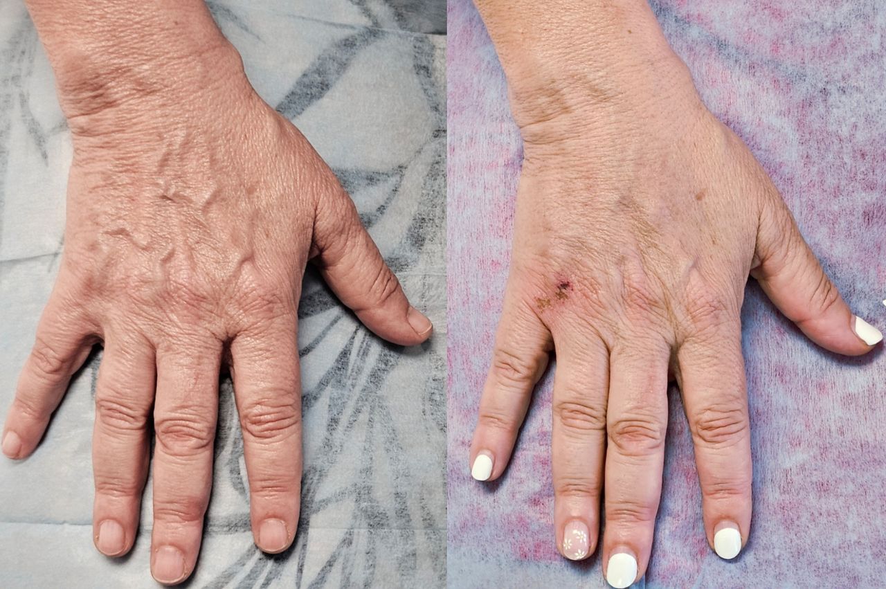 Rosalba Herrero Zerpa-552