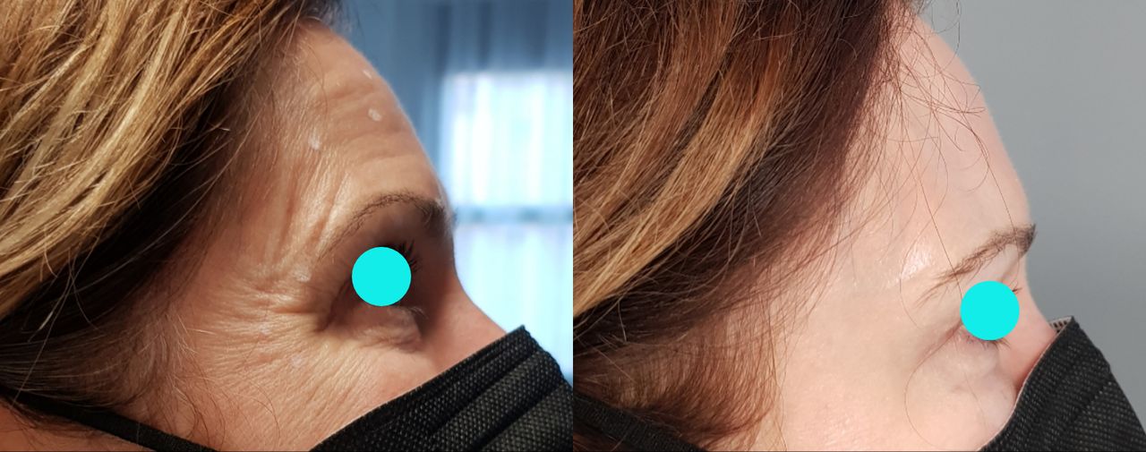 Rosalba Herrero Zerpa-508