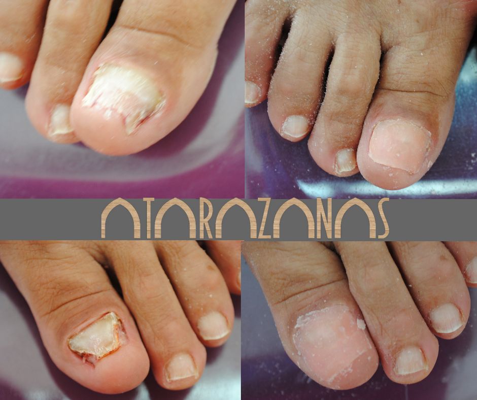 Salomé Antón Arnal-33