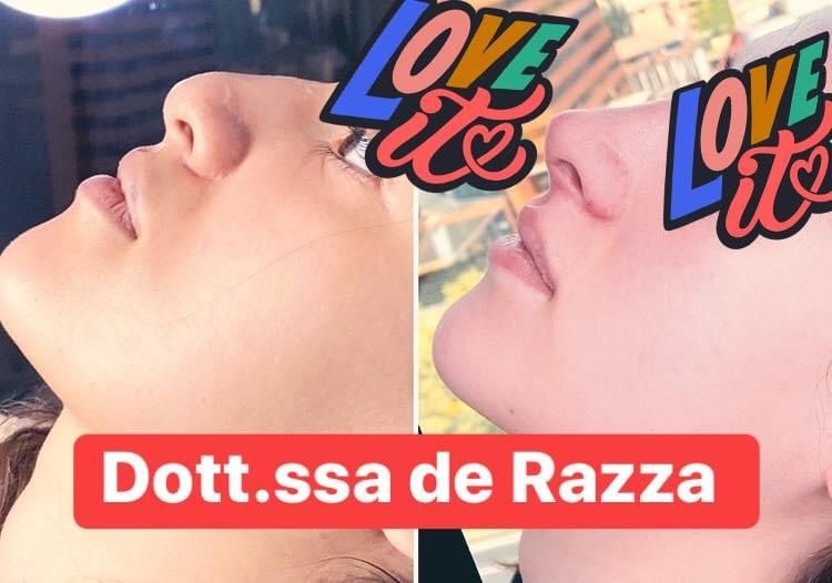 Francesca De Razza-26