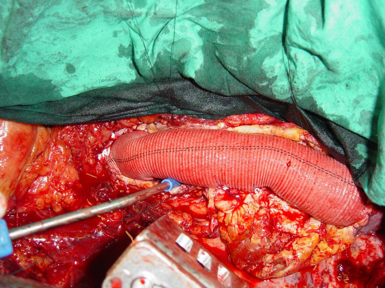 Secundino Llagostera Pujol-2