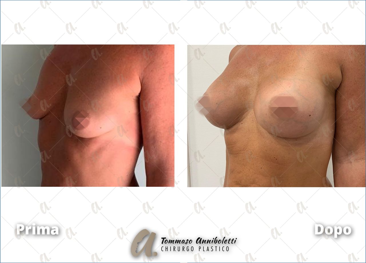 Tommaso Anniboletti-33