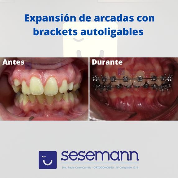 Paula Cano Carrillo-77