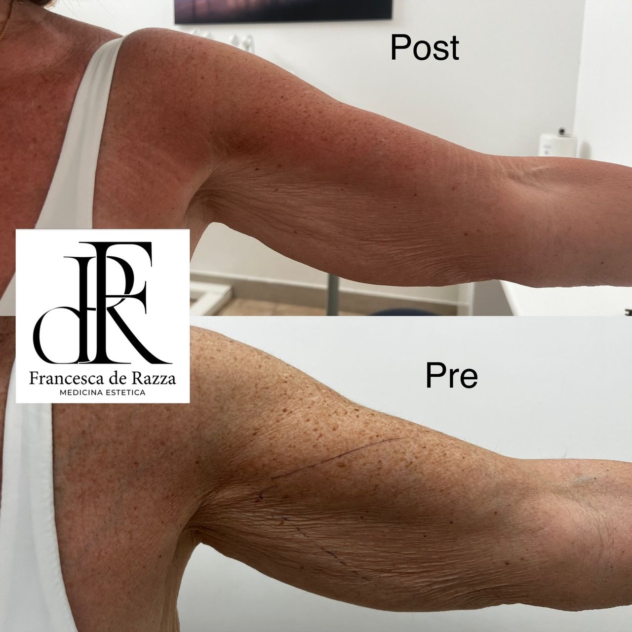 Francesca De Razza-68