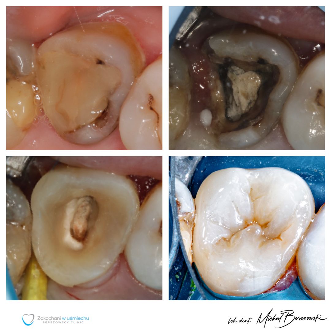 Michał Berezowski-37