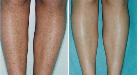 Enzo Angelo Giudice-16