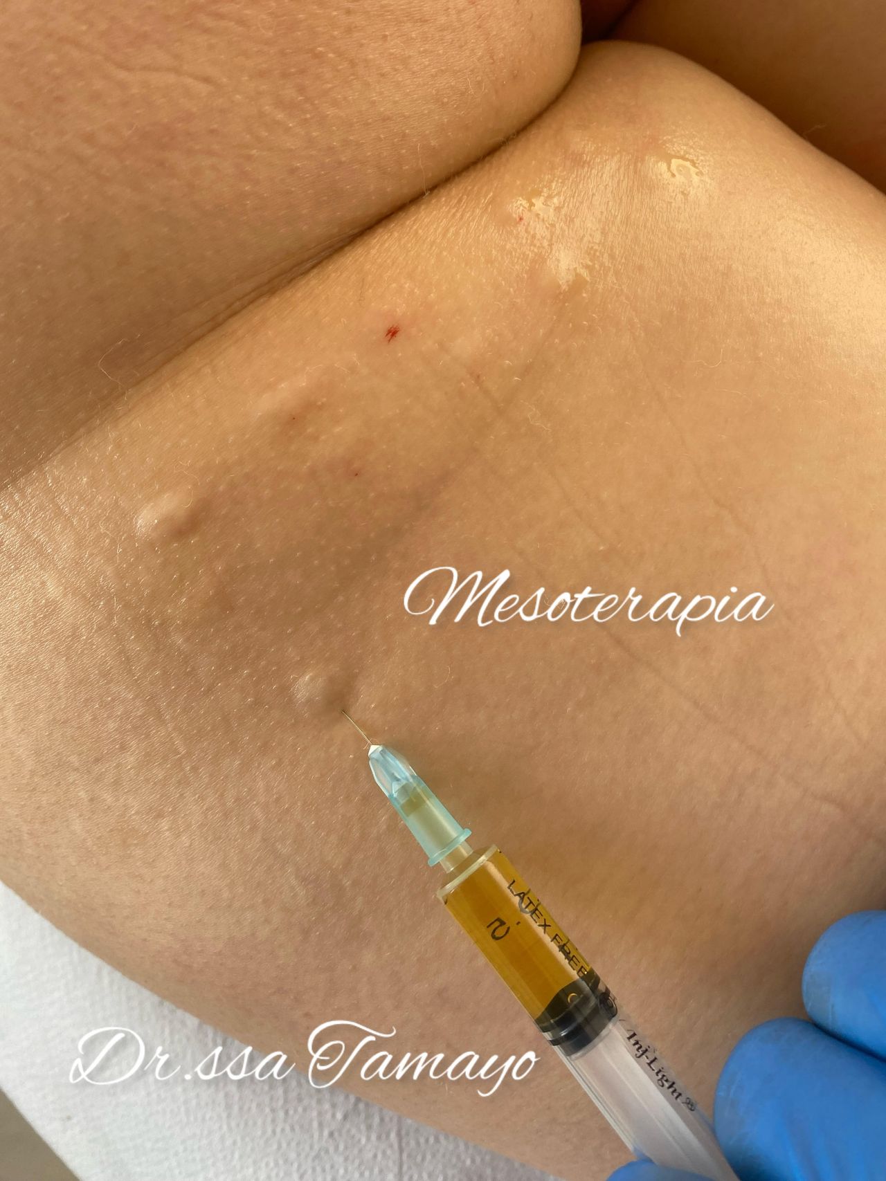 Lazara Dianelys Tamayo-18