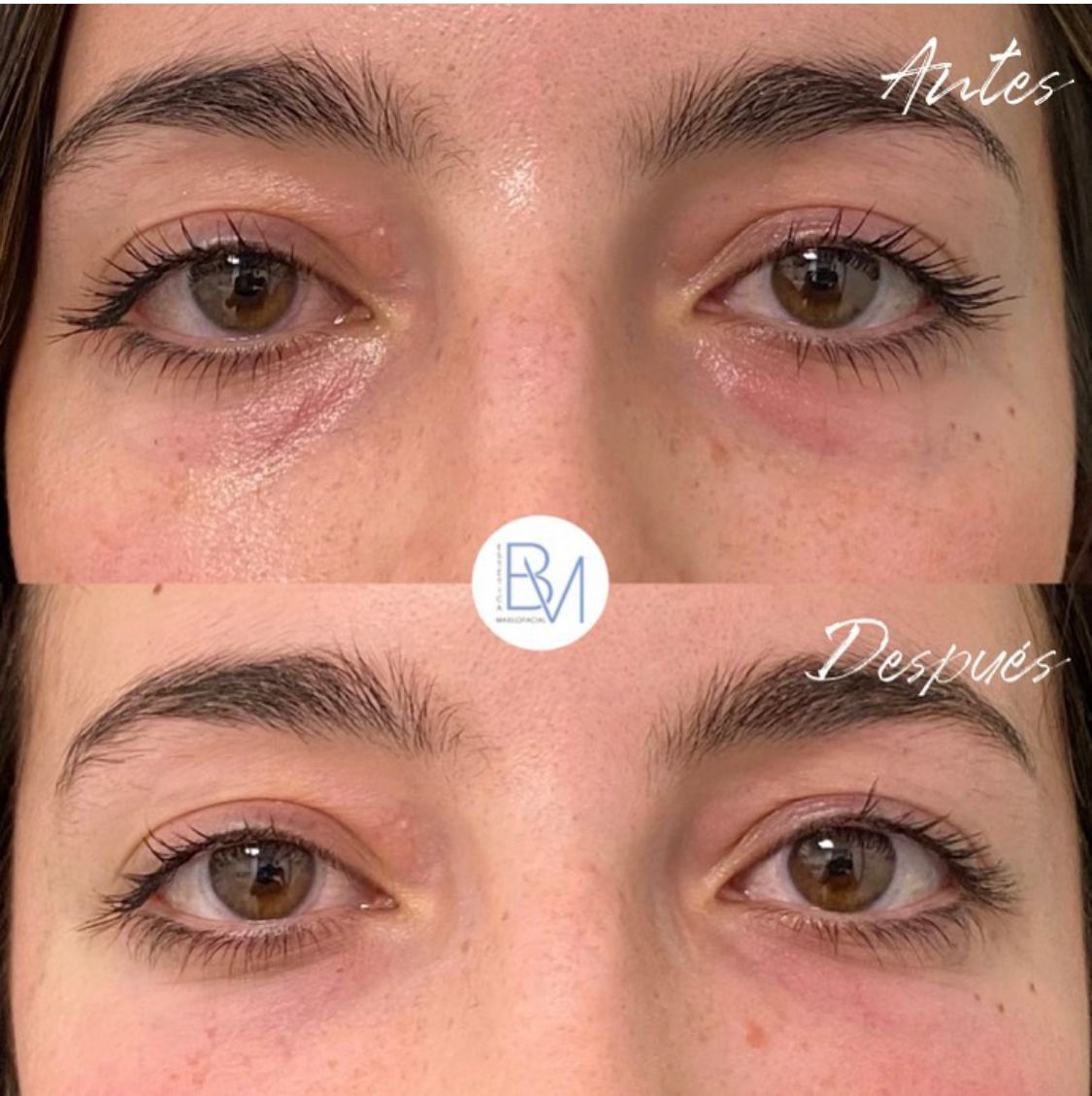 Beatriz Moralejo-116